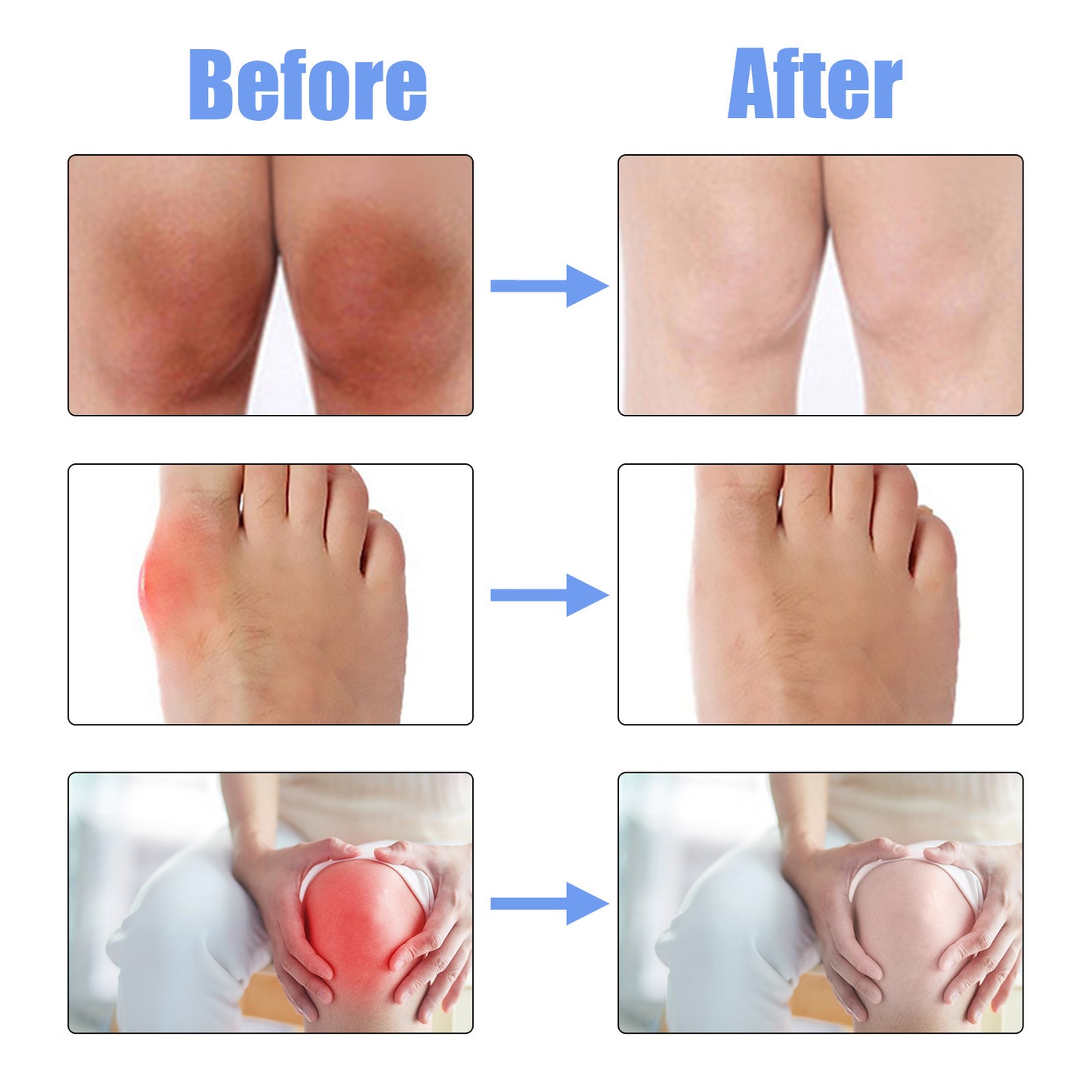 Joint Repair Spray Relieving Hand, Ankle And Knee Joint