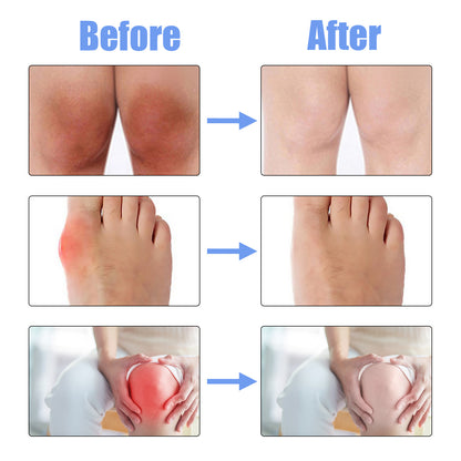 Joint Repair Spray Relieving Hand, Ankle And Knee Joint